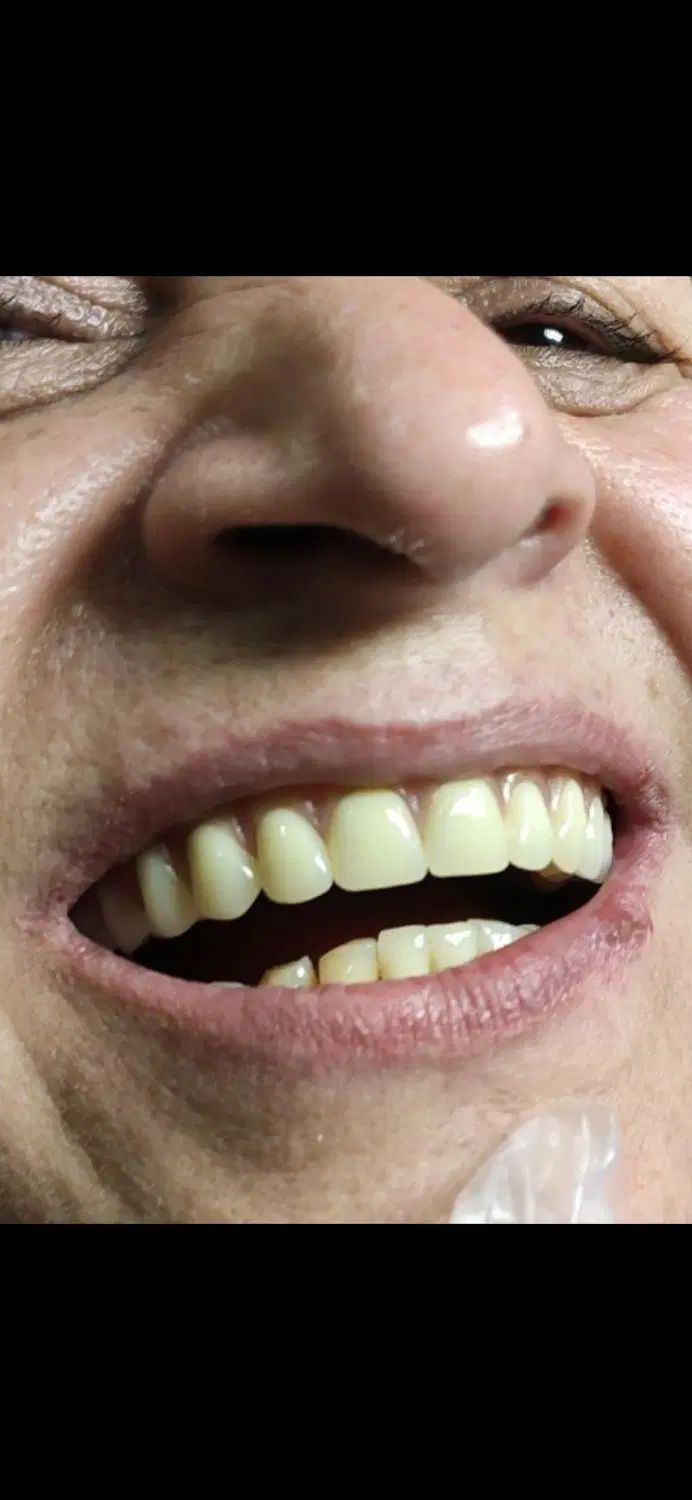 تخفیف ویژه کلیه خدمات دندانسازی برلیان|خدمات آرایشگری و زیبایی|تهران, سید خندان (جلفا)|دیوار