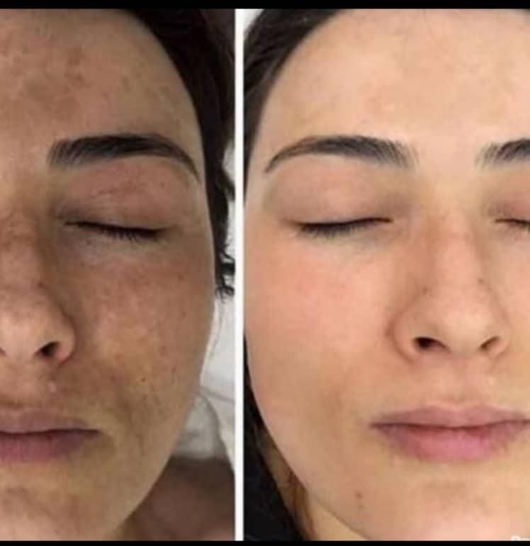 کرم معجزه۴۳ترکیبه کلاژن گیاهی سفید کنندی قوی|آرایشی، بهداشتی، درمانی|شیراز, سلطان آباد|دیوار
