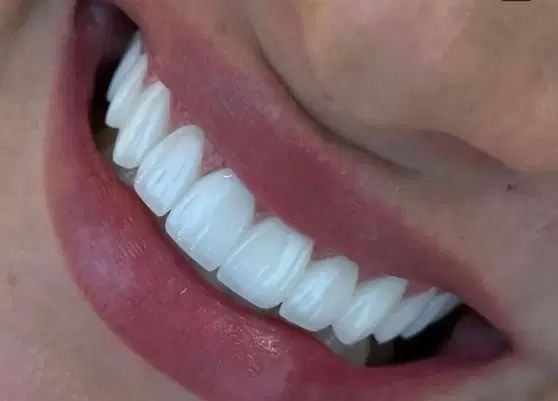 مرکز تخصصی زیبایی دندان در دو‌شعبه ورامین وتهران‌|خدمات آرایشگری و زیبایی|قرچک, مهدیه|دیوار