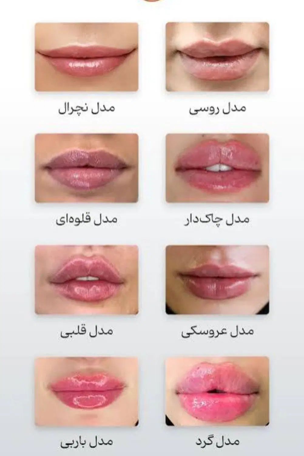 تخفیفات خدمات زیبایی فیلر بوتاکس نخ لیزر پاکسازی|خدمات آرایشگری و زیبایی|یزد, |دیوار