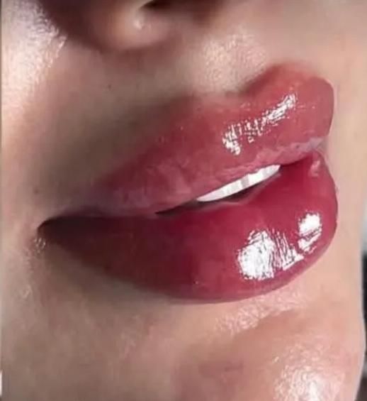 دکتر اکرم آقابیگی پوست مو زیبایی|خدمات آرایشگری و زیبایی|ملایر, |دیوار