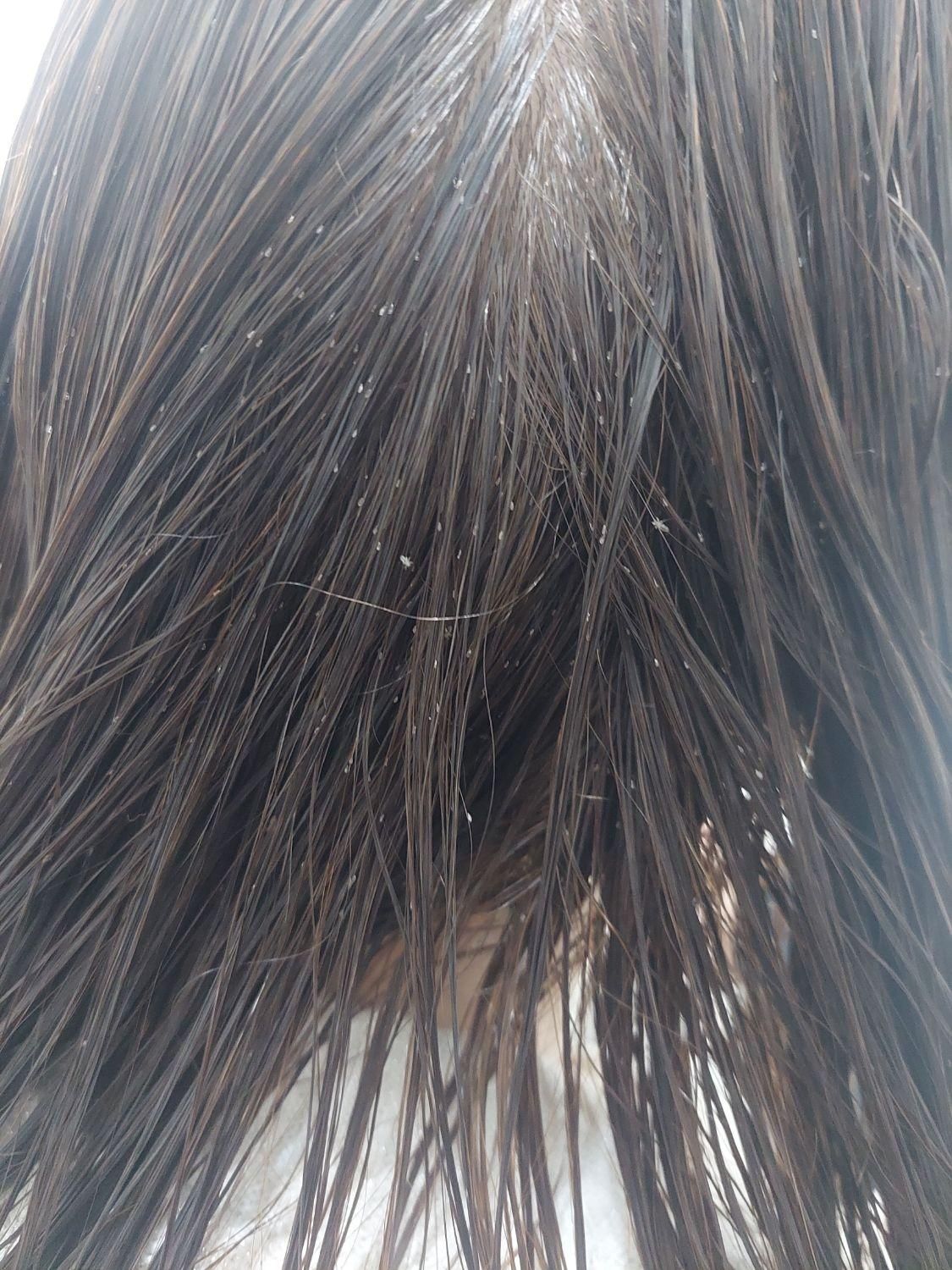 پاکسازی رشک و شپش موی سر در شهرک شهید رجایی|خدمات آرایشگری و زیبایی|مشهد, انصار|دیوار