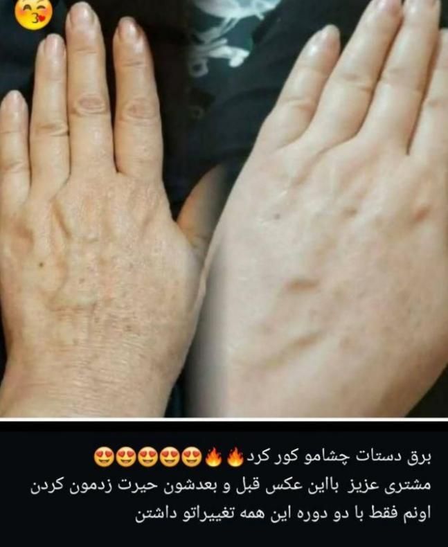 با من دیگه هیچ وقت پیر نمیشی|آرایشی، بهداشتی، درمانی|رشت, منظریه|دیوار