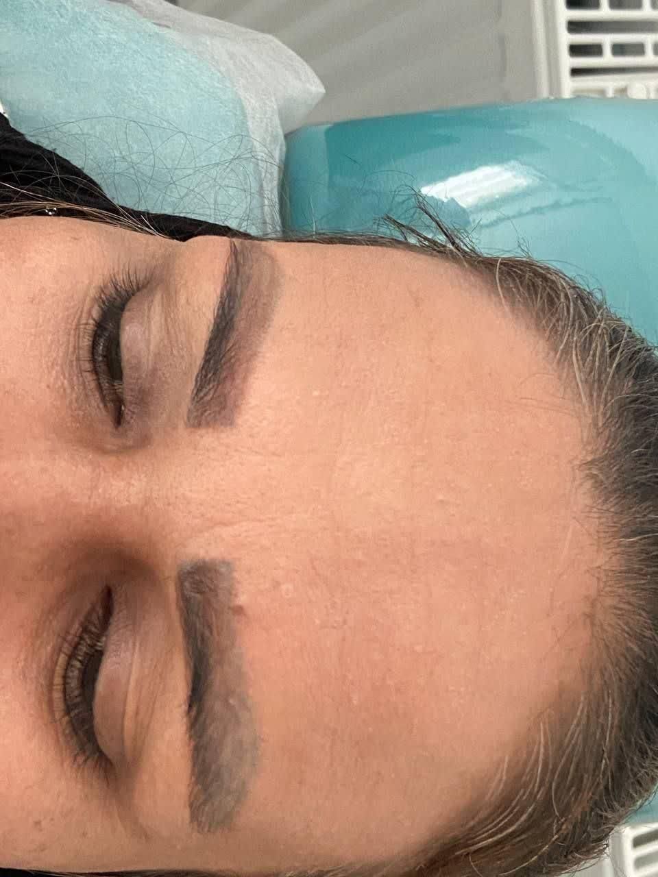 کلینیک تخصصی ریموتتوبا لیزر کیوسوئیچ و کربن تراپی|خدمات آرایشگری و زیبایی|مشهد, احمدآباد|دیوار