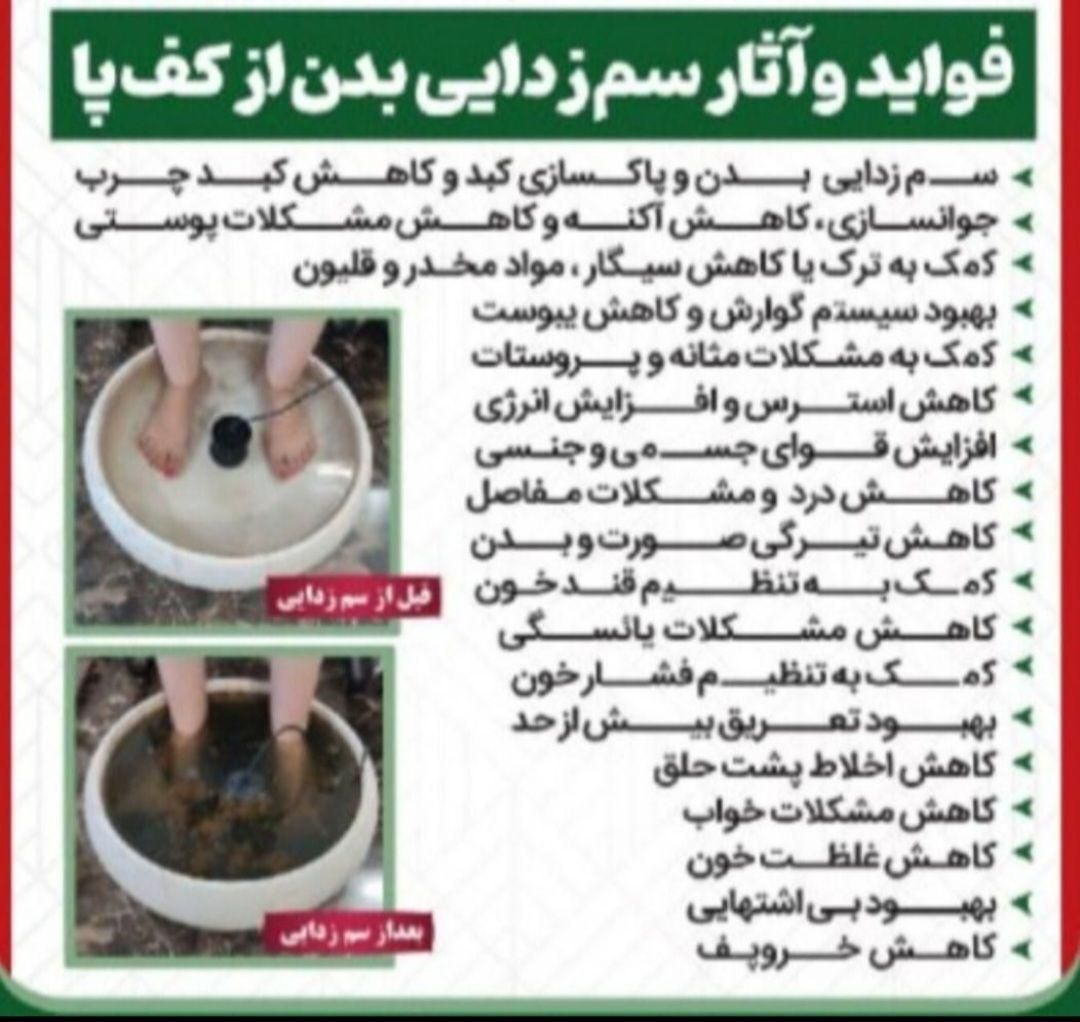 حجامت زالو سم زدایی شستشو گوش لاغری|خدمات آرایشگری و زیبایی|مشهد, شهید آوینی|دیوار