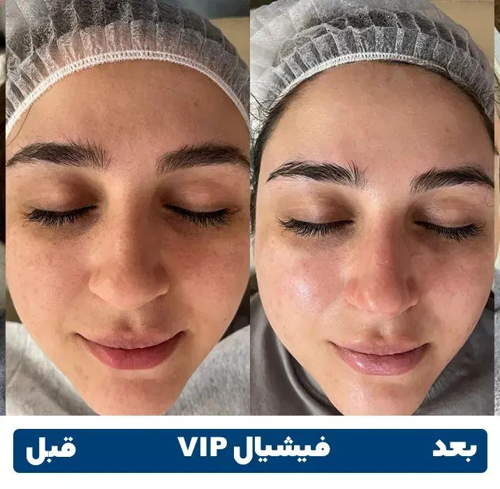 فشیال کلاسیکvip پوست فقط 400تومان به جای 600تومان|خدمات آرایشگری و زیبایی|کرمان, |دیوار