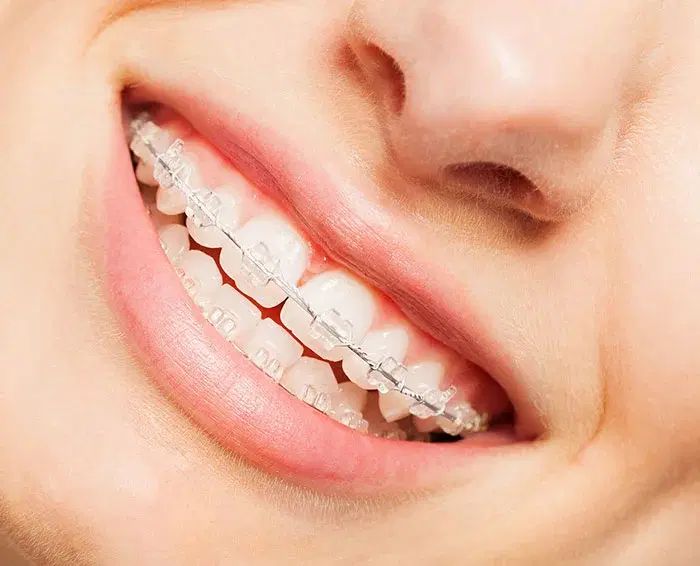 دندان پزشکی/ ایمپلنت بدون بخیه/اوردنچر/روکش|خدمات آرایشگری و زیبایی|تبریز, |دیوار