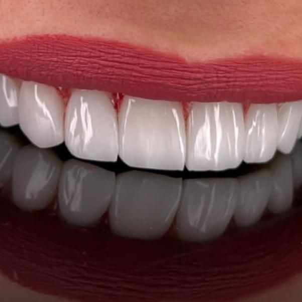 دندانپزشکی کامپوزیت و درمانی|خدمات آرایشگری و زیبایی|تهران, سلسبیل جنوبی|دیوار