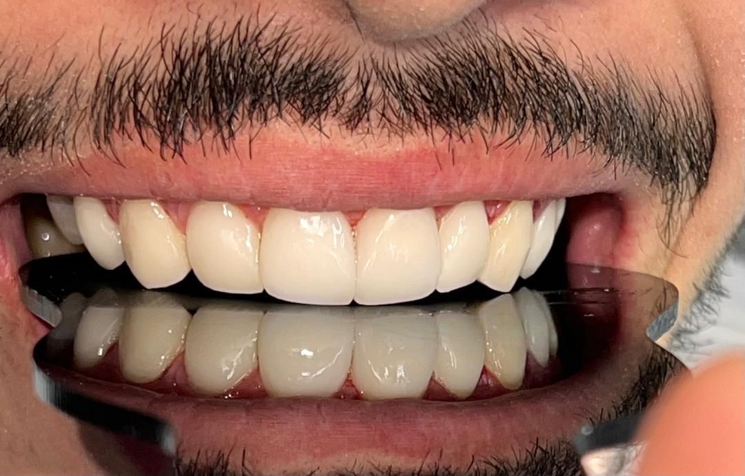 دندانپزشکی درمانی ایمپلنت زیبایی  با بهترین قیمت|خدمات آرایشگری و زیبایی|تهران, فلسطین (میدان انقلاب)|دیوار