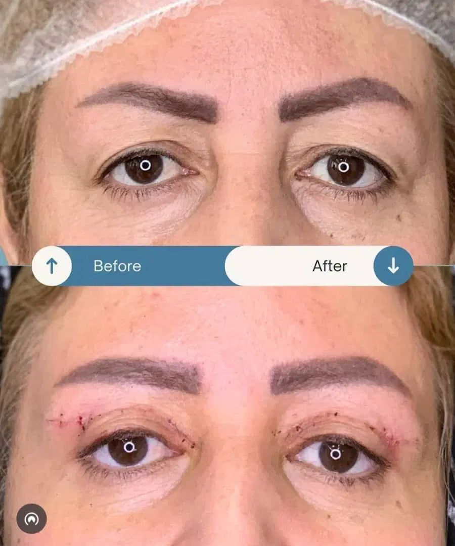 زیبایی لیفت بلفارو فرم بینی بوتاکس نخ ابروزاویه ژل|خدمات آرایشگری و زیبایی|اصفهان, خانه اصفهان|دیوار
