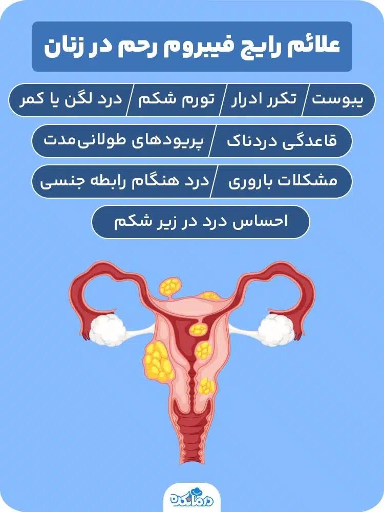 بهبود فیبروم و کیست و نازایی مطمئن و موثر|آرایشی، بهداشتی، درمانی|سمنان, |دیوار