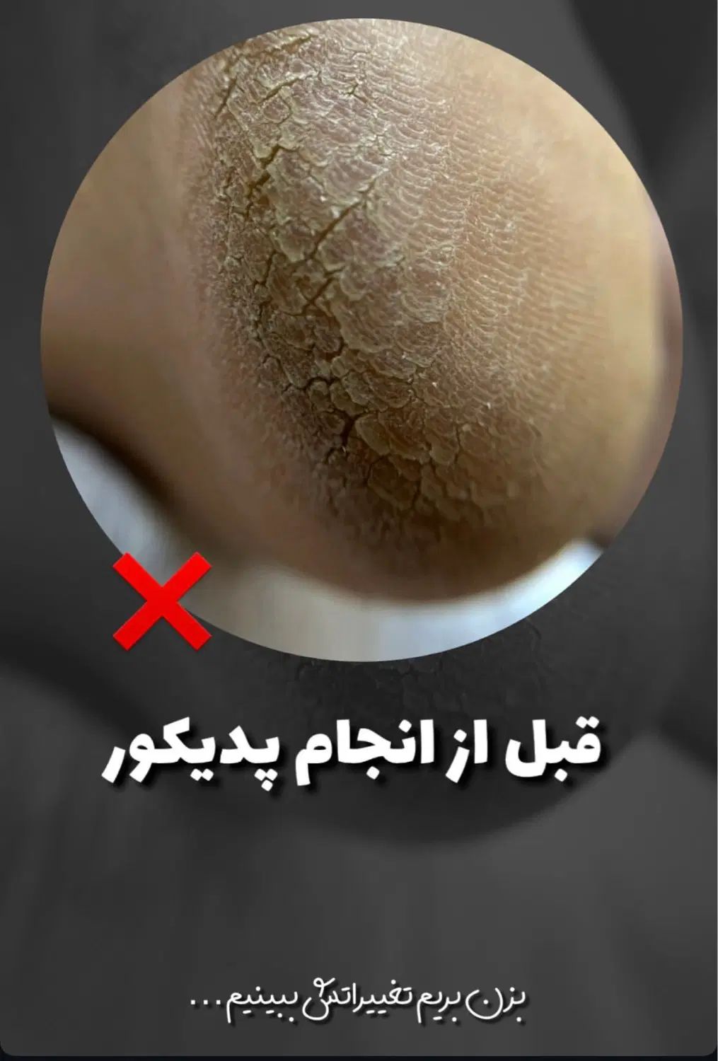 پدیکور تخصصی|خدمات آرایشگری و زیبایی|کرج, اتحاد|دیوار