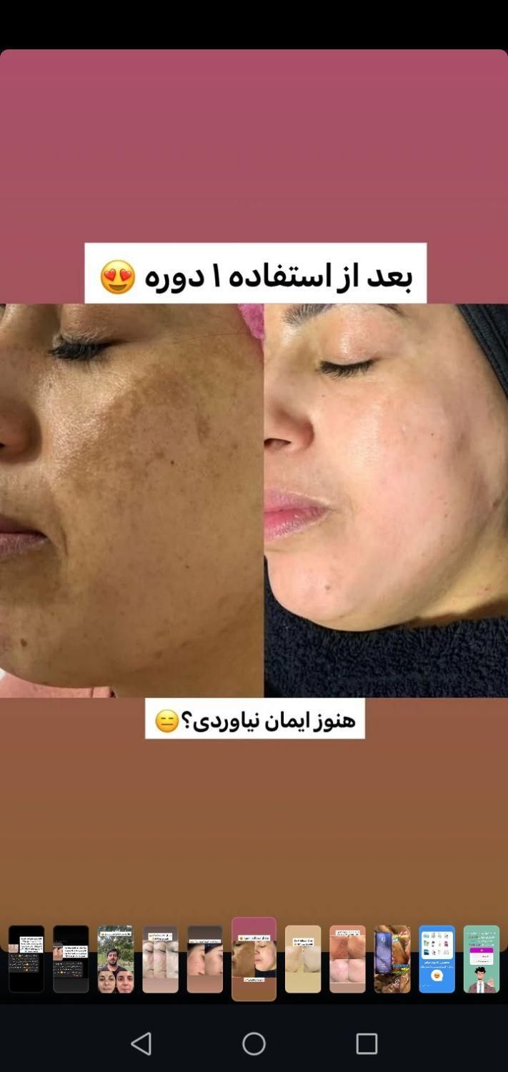 محصولات آرایشی و بهداشتی و درمانی وکرم های ضدلک|آرایشی، بهداشتی، درمانی|شیراز, گویم|دیوار