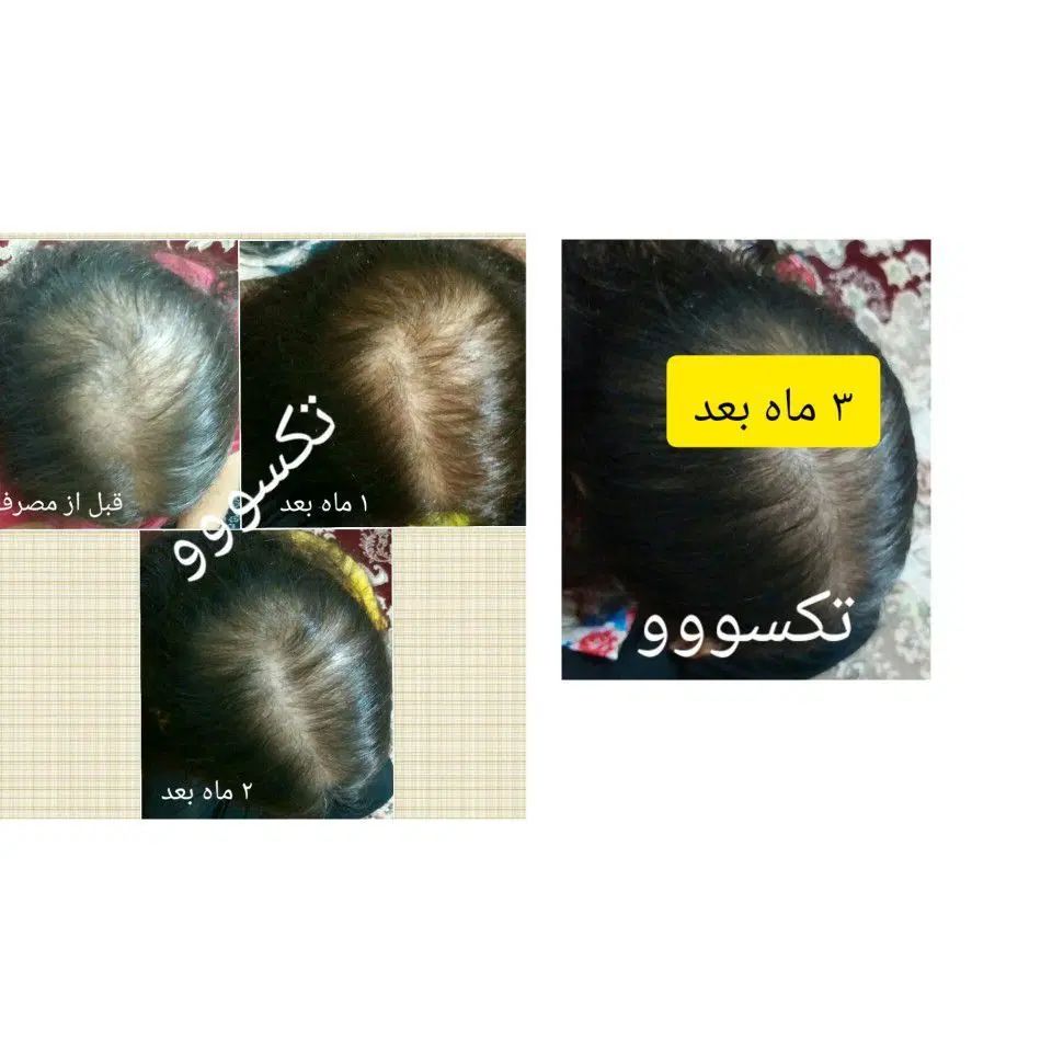 موهای بلند پرپشت داشته باشید|آرایشی، بهداشتی، درمانی|رشت, آزادگان|دیوار