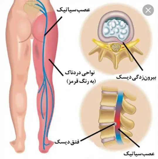 حجامت تخصصی، قلنج گیری رگیری رفع درد سیاتیک..|خدمات آرایشگری و زیبایی|مشهد, شاهد (شهرک غرب)|دیوار