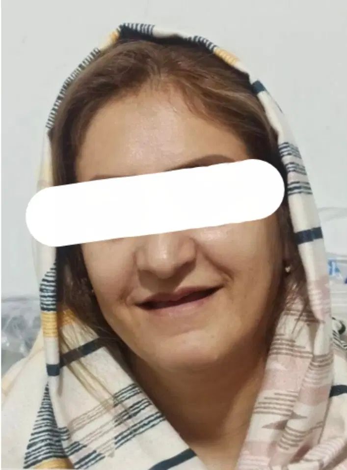 دندان مصنوعی - دندانسازی -تخفیف ویژه و تعرفه دولتی|خدمات آرایشگری و زیبایی|مشهد, فاطمیه|دیوار