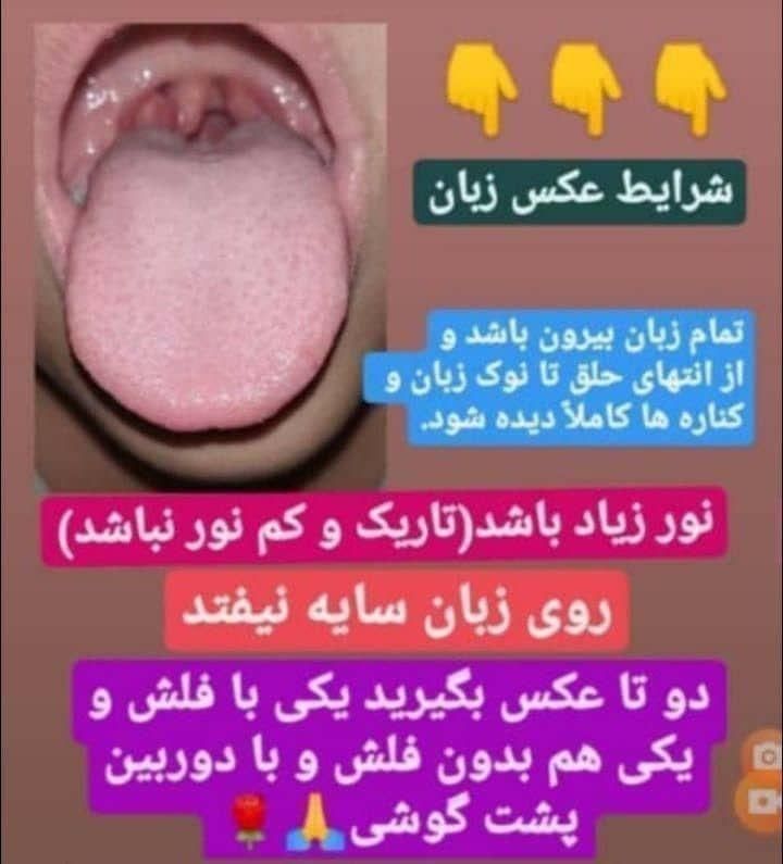 بیماریهای بدنت رو از روی عکس زبانت تشخیص میدم|فعالیت داوطلبانه|نوشهر, |دیوار