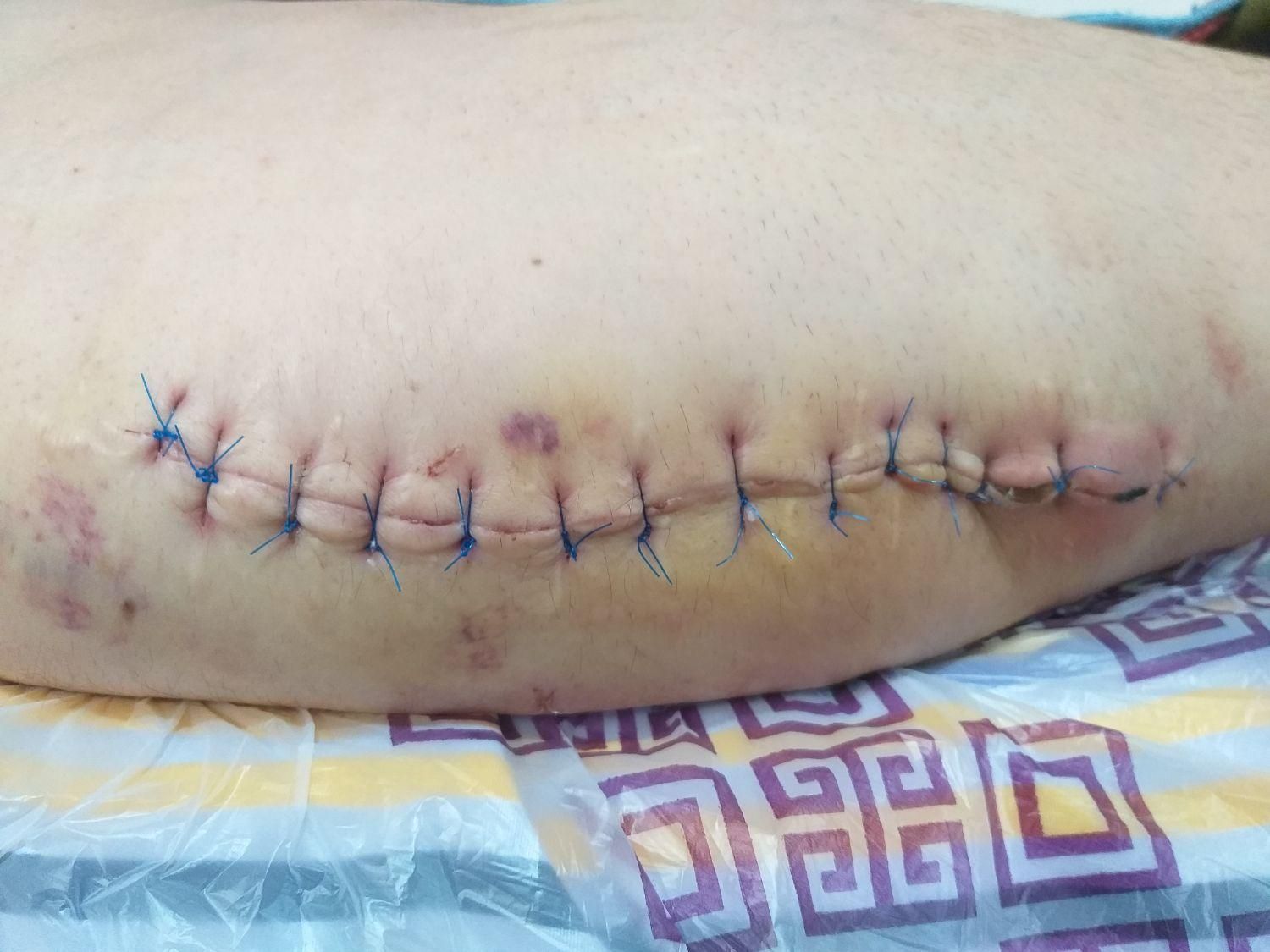 خدمات پرستاری و تزریقات در منزل محمودآباد|خدمات آرایشگری و زیبایی|محمودآباد, |دیوار