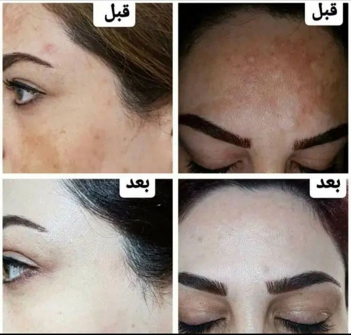 کرم وی ای پی اصل صدرصد تضمینی سفیدکننده قوی|حراج|یاسوج, |دیوار