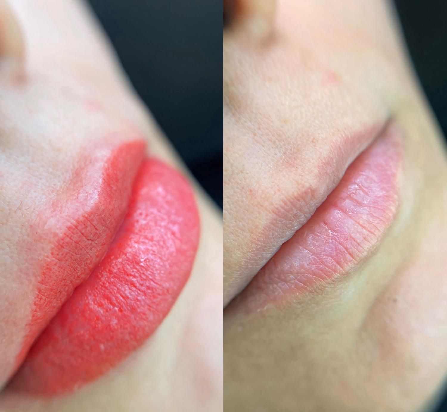 مدل میکروبلیدینگ فیبروز شیدینگ لب خط چشم ریموو|خدمات آرایشگری و زیبایی|تهران, سردارجنگل|دیوار