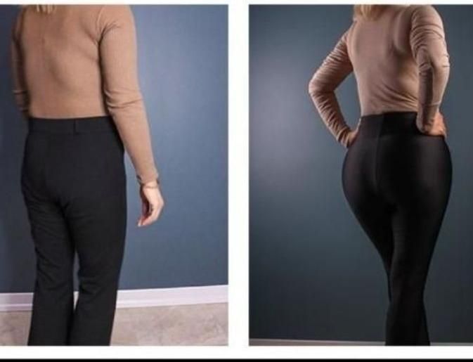 مرکز تخصصی لاغری موضعی و فرمدهی بدن|خدمات آرایشگری و زیبایی|قزوین, |دیوار