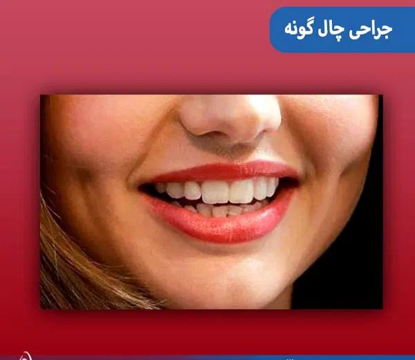 ساکشن غبغب وبوکال فت و چال گونه توسط پزشک در مطب|خدمات آرایشگری و زیبایی|مشهد, شهید فرامرز عباسی|دیوار