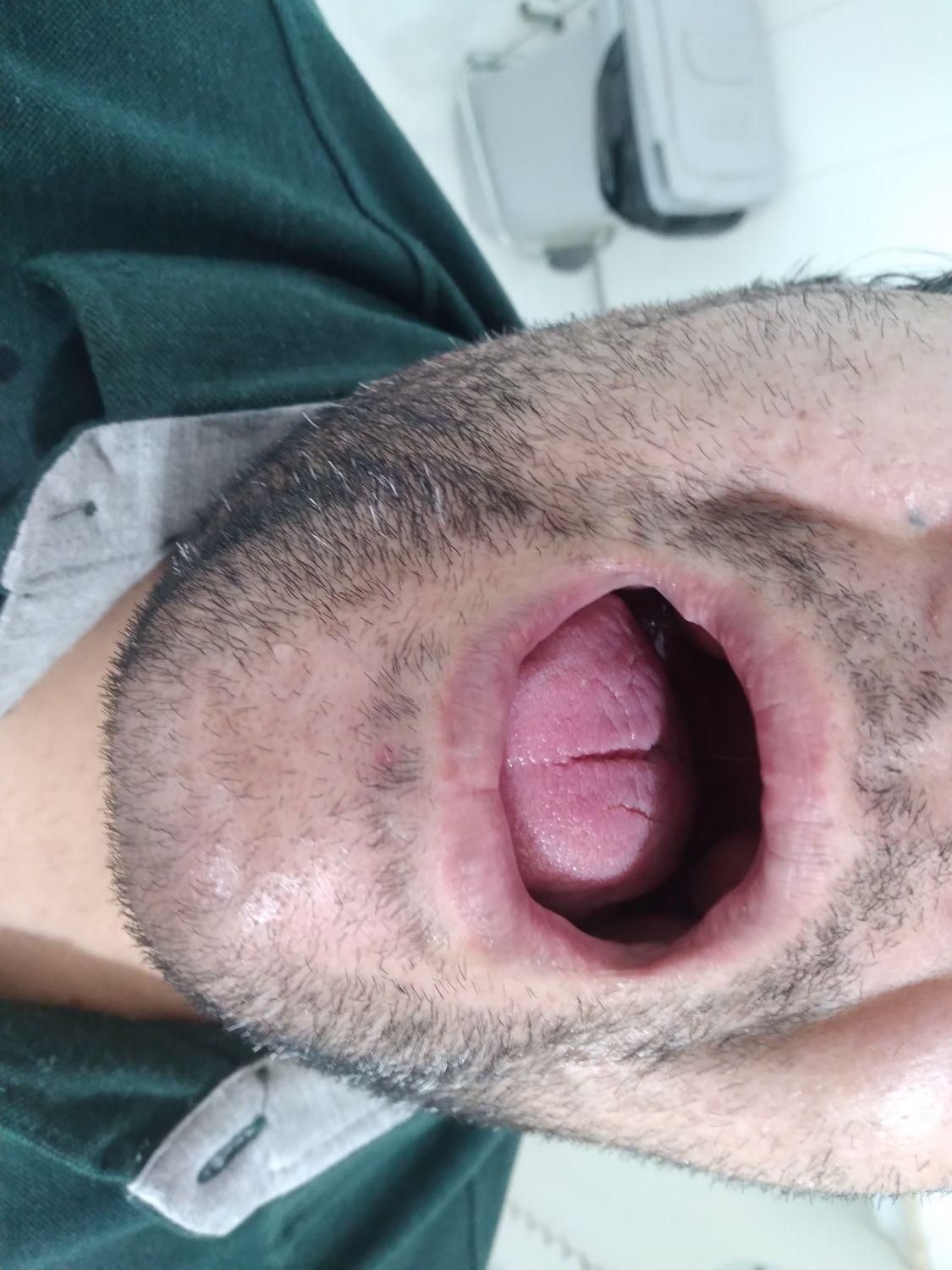 دندانسازی (دندان مصنوعی)پروتز متحرک|خدمات آرایشگری و زیبایی|قم, شاه ابراهیم|دیوار