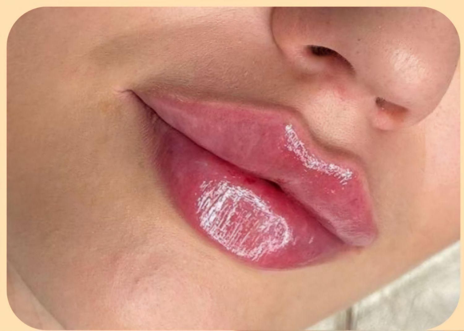 جوانسازی ژل و مزوژل و..|خدمات آرایشگری و زیبایی|برازجان, |دیوار