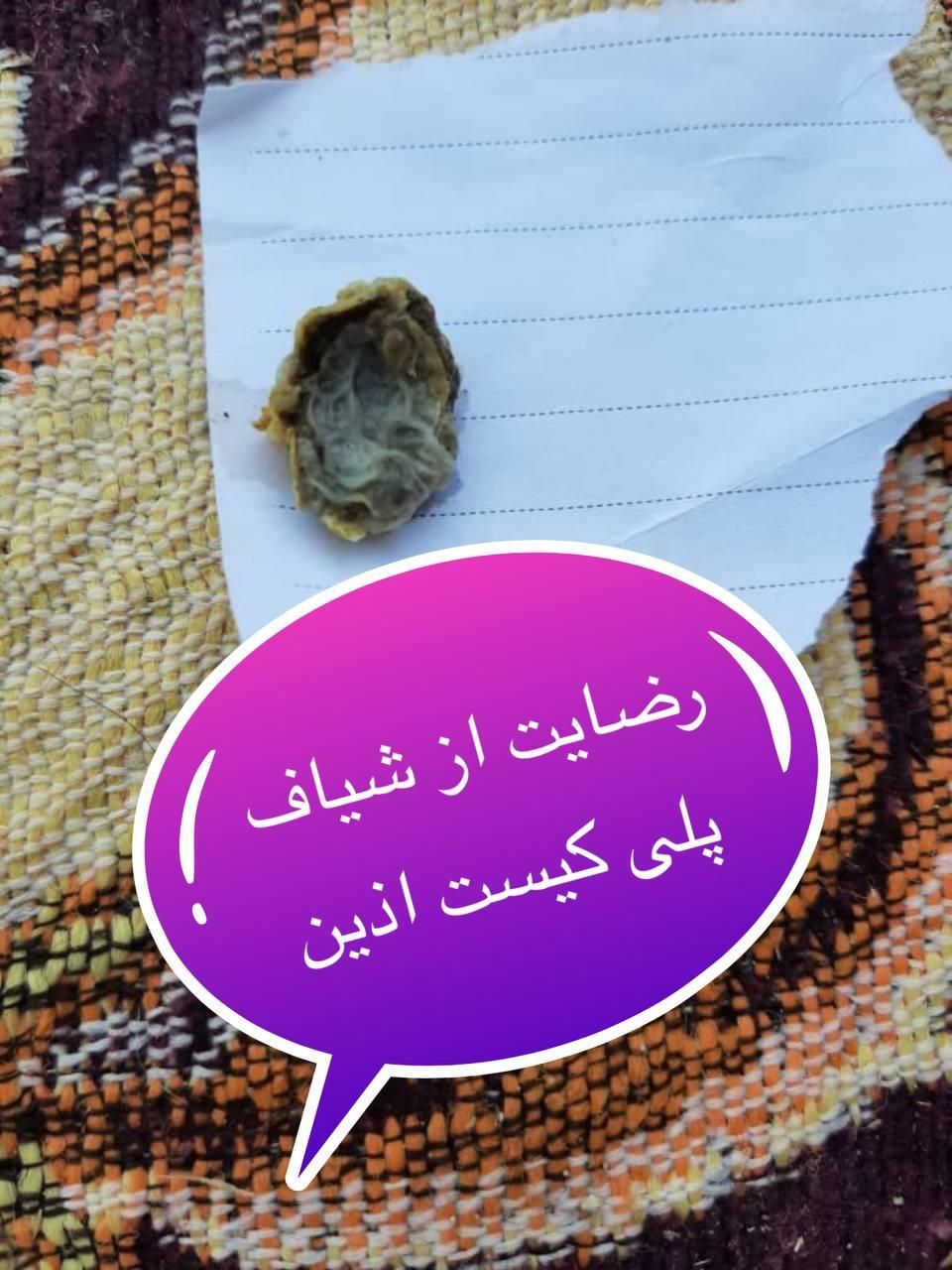 بهبود فیبروم و کیست و نازایی مطمئن و موثر|آرایشی، بهداشتی، درمانی|سمنان, |دیوار