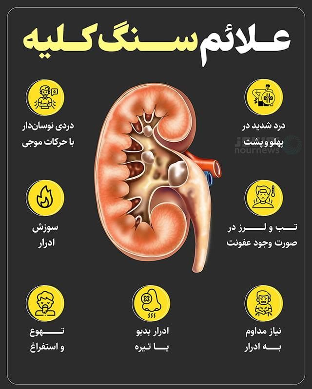 سنگ کلیه داری|آرایشی، بهداشتی، درمانی|ایلام, |دیوار