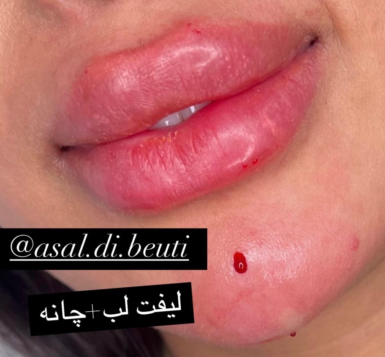 تخفیف ویژه ژل لب، فول فیس اموزش و تمام خدمات|خدمات آرایشگری و زیبایی|صدرا-فارس, فاز ۱|دیوار