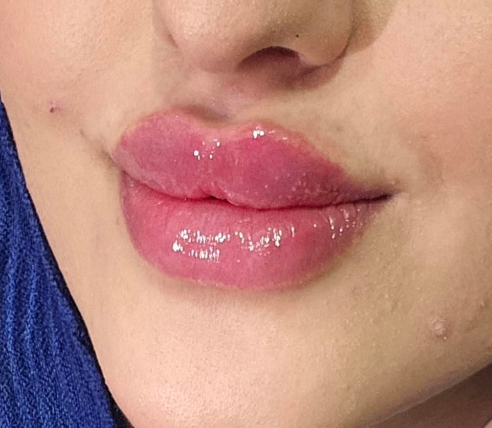 تزریق ژل و بوتاکس با تخفیف ویژه بهاری*|خدمات آرایشگری و زیبایی|جوانرود, |دیوار