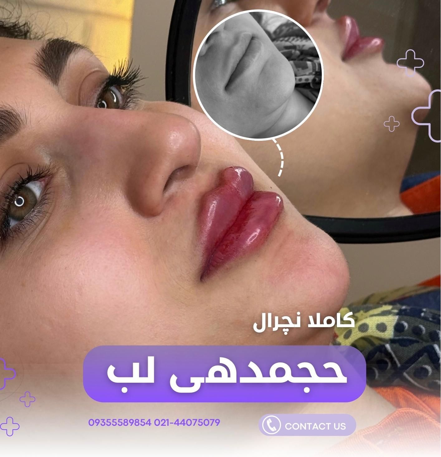 ادیت محتوا اینستاگرام|خدمات رایانه‌ای و موبایل|تهران, چیتگر جنوبی|دیوار
