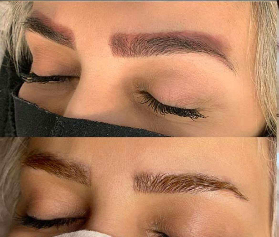 لیزر موهای زائد/ریمو تتو/لاغری/ژل/بوتاکس|خدمات آرایشگری و زیبایی|تهران, سعادت‌آباد|دیوار