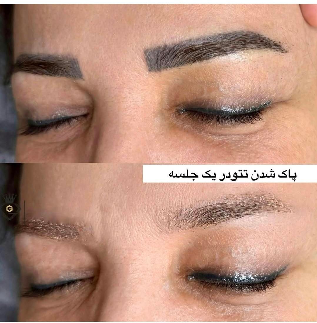 ریمو کاملا تخصصی تضمینی با مدرس بین الملی|خدمات آرایشگری و زیبایی|آبادان, |دیوار