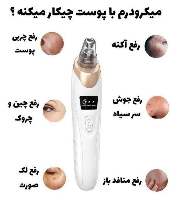 میکرودرم پاکسازی پوست صورت|حراج|همدان, |دیوار