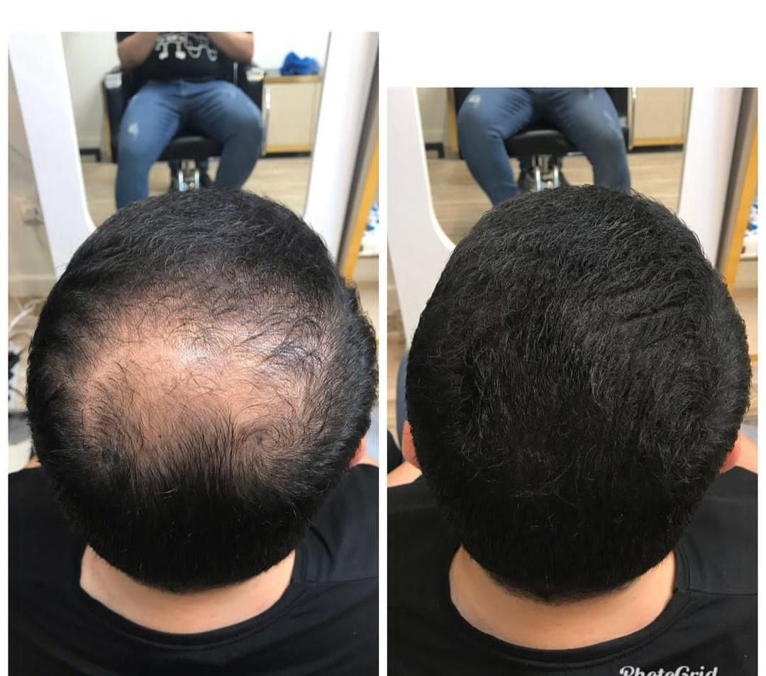 پیرایش مردانه ژون|خدمات آرایشگری و زیبایی|رشت, سعدی (تختی)|دیوار