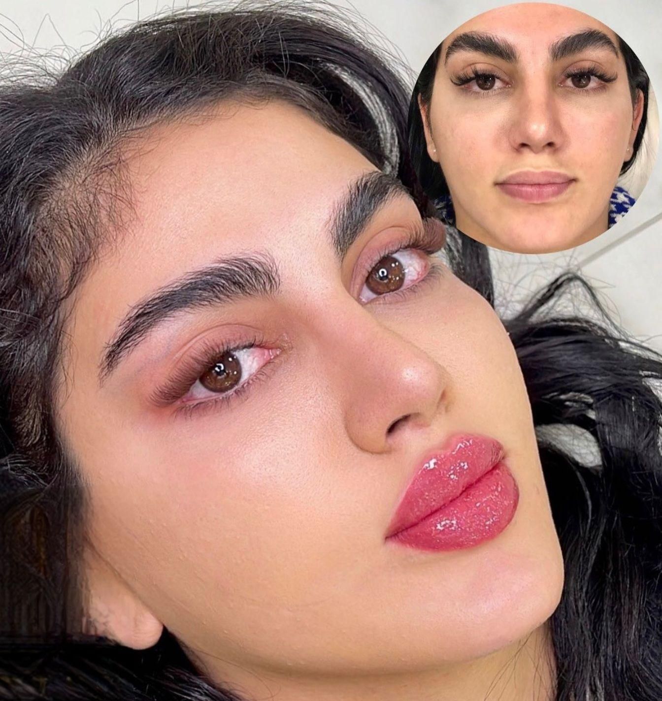 تزریق چربی، ژل وبوتاکس ومادلینگ صورت توسط پزشک|خدمات آرایشگری و زیبایی|کرمانشاه, |دیوار