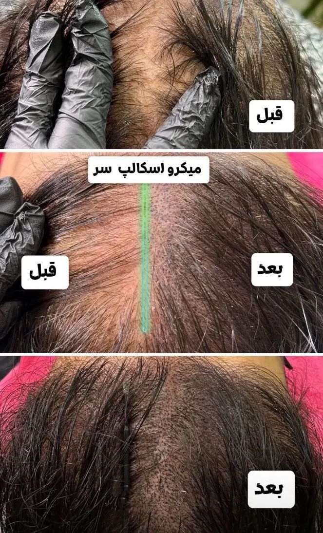 آخرین آف در زاهدان توسط مربی از کرج و مشهد|خدمات آرایشگری و زیبایی|زاهدان, |دیوار