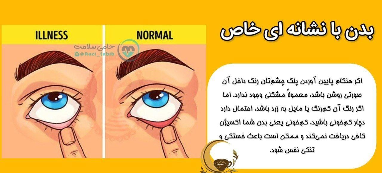 خانمای عزیز بگوش باشید|آرایشی، بهداشتی، درمانی|اصفهان, ارغوانیه|دیوار