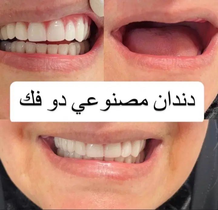 دندانساری متحرک(مصنوعی)|خدمات آرایشگری و زیبایی|اصفهان, جاوان|دیوار