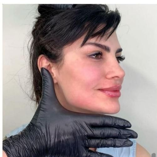 آموزش ژل بوتاکس نخ مدل پزشک هایفو آنزیم مزوتراپی|خدمات آرایشگری و زیبایی|تهران, ستارخان|دیوار