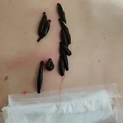 بادکش درمانی و حجامت در منزل سراسر تهران|خدمات آرایشگری و زیبایی|تهران, تهرانپارس شرقی|دیوار
