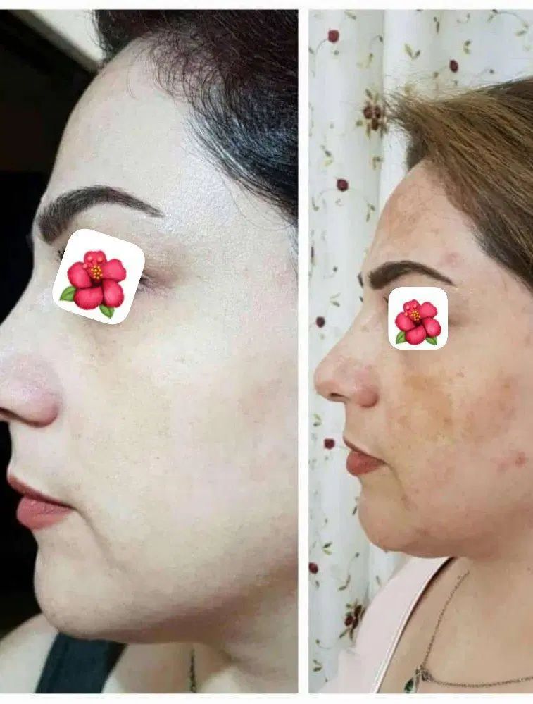 کرم عربی ۴۵ترکیب گیاهی جدیدترین کرم سال|آرایشی، بهداشتی، درمانی|یزد, |دیوار
