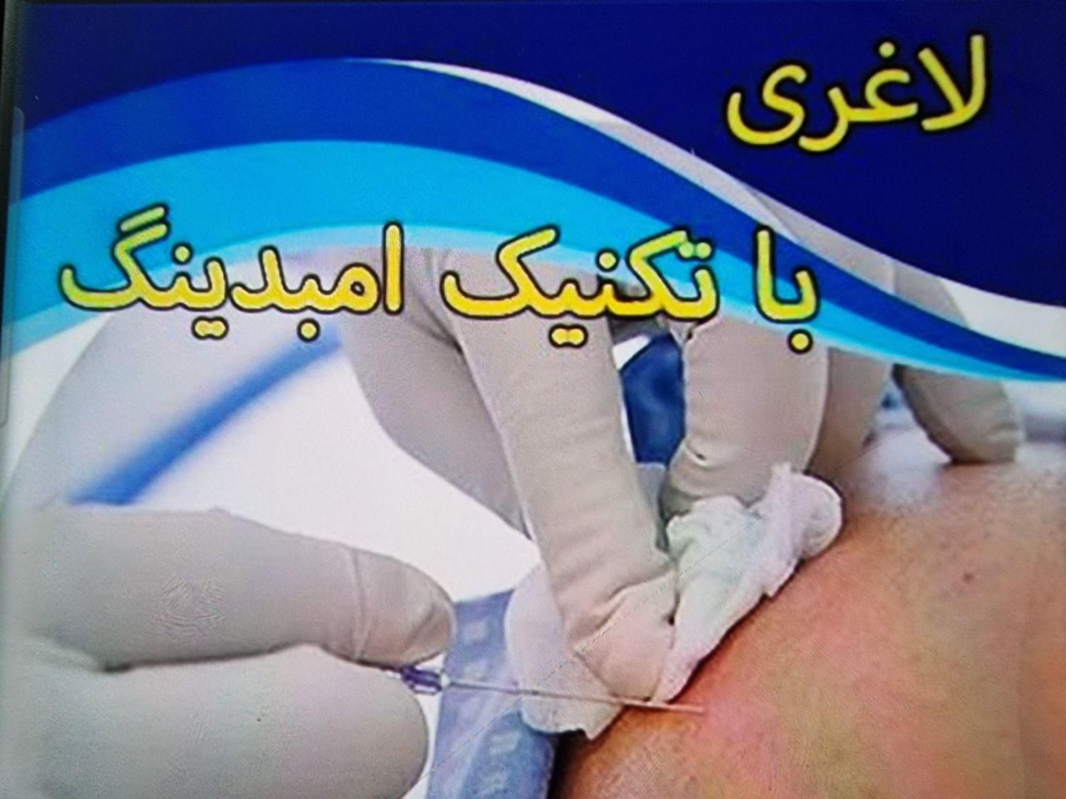 امبدینگ.لاغری بدون عوارض|خدمات آرایشگری و زیبایی|مشهد, عامل|دیوار