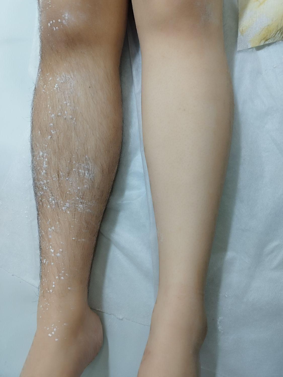 مرکز اپیلاسیون تخصصی بانوان در قاسم آباد|خدمات آرایشگری و زیبایی|مشهد, شهرک رازی (شهرک غرب)|دیوار