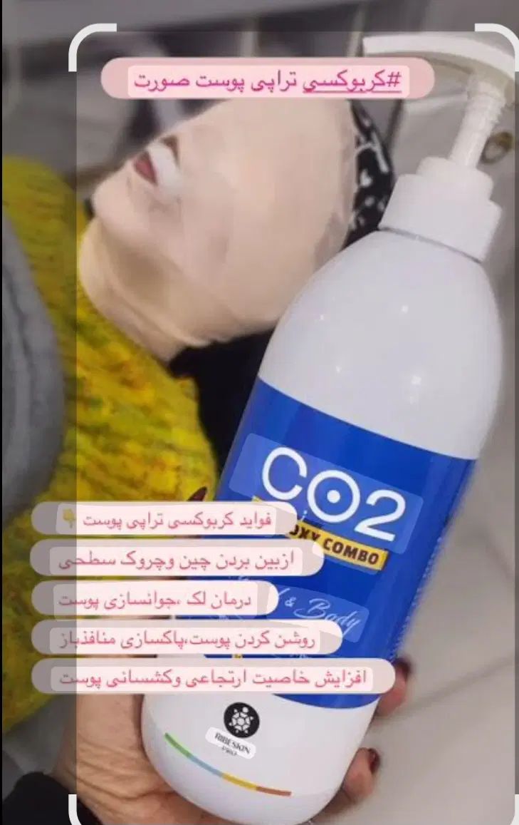 فشیال کلاسیکvip پوست فقط 400تومان به جای 600تومان|خدمات آرایشگری و زیبایی|کرمان, |دیوار