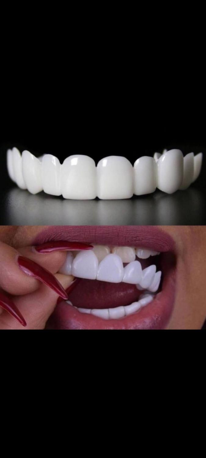 لمینت دندان/پرداخت درب منزل/باقیمت تخفیفی|آرایشی، بهداشتی، درمانی|کاشان, حسن آباد|دیوار