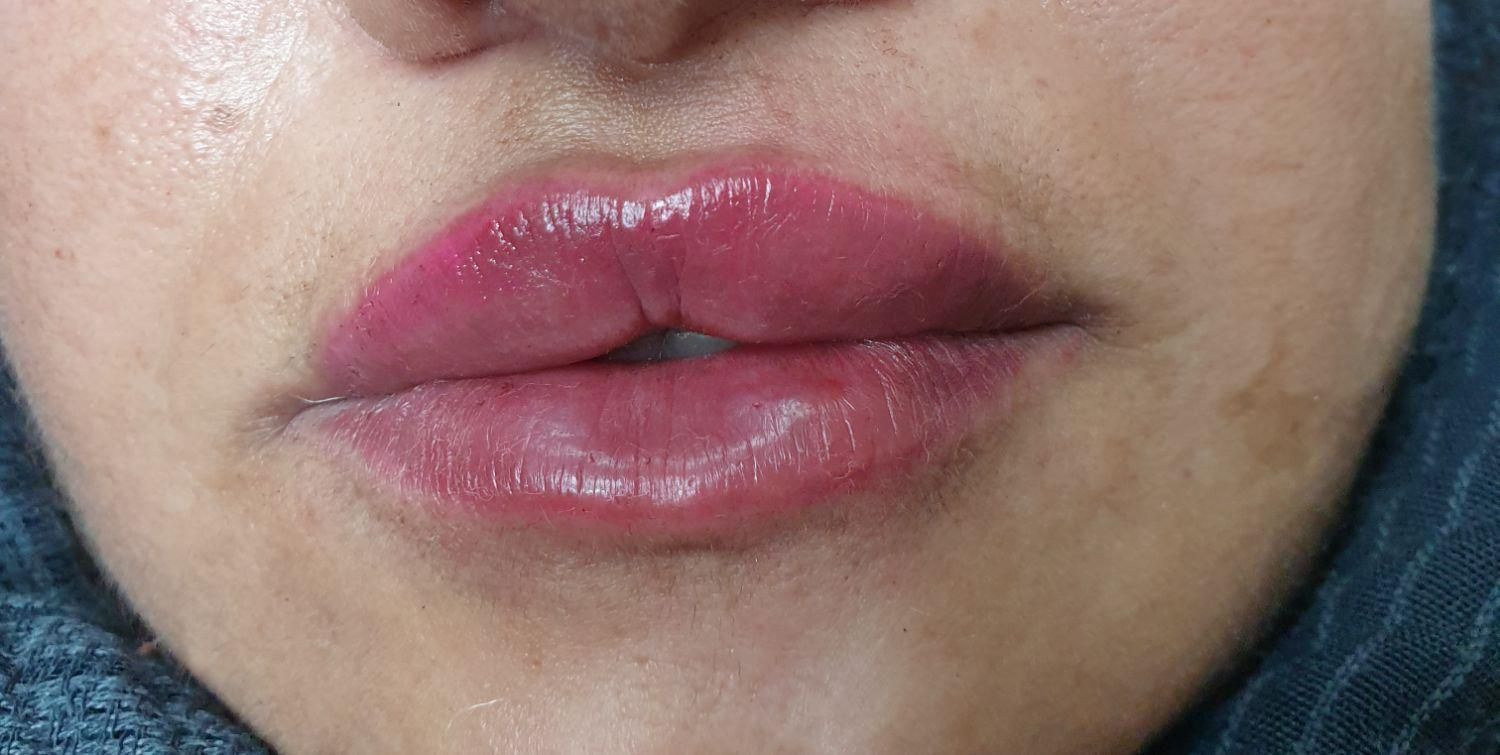 تخفیفات زیبایی و عملهای جراحی|خدمات آرایشگری و زیبایی|دوگنبدان, |دیوار