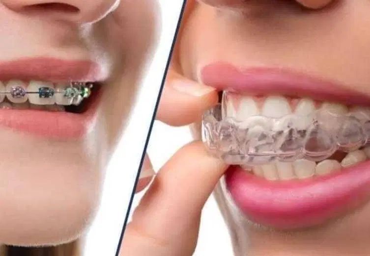ارتودنسی مطب ماه|خدمات آرایشگری و زیبایی|تهران, عباس‌آباد|دیوار